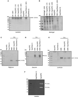 Leptospira interrogans Secreted Proteases Degrade Extracellular Matrix and Plasma Proteins From the Host